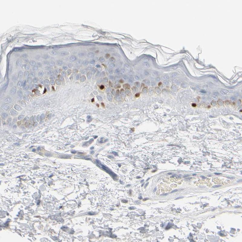 Staining of human skin shows moderate to strong nuclear positivity in melanocytes.