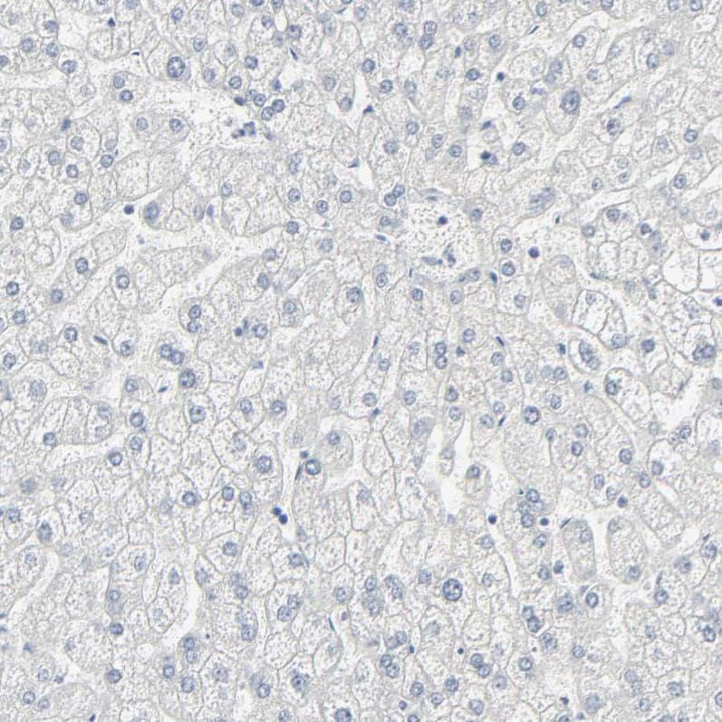 Staining of human liver shows no positivity in hepatocytes as expected.