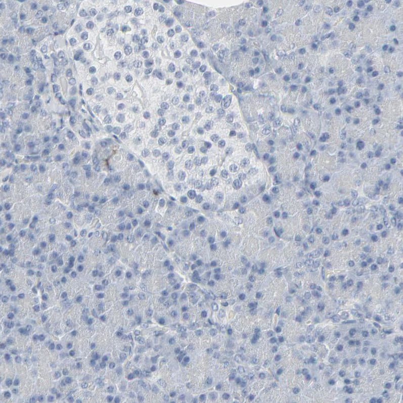Staining of human pancreas shows no positivity in exocrine glandular cells as expected.