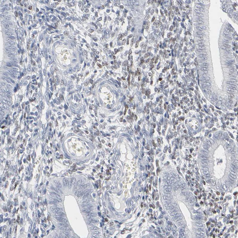 Staining of human endometrium shows moderate nuclear positivity in cells in endometrial stroma.