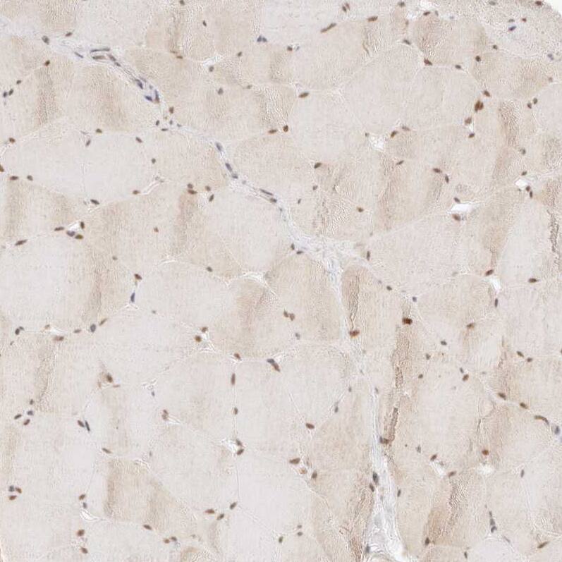 Immunohistochemistry-Paraffin ASCL3 Antibody - BSA Free