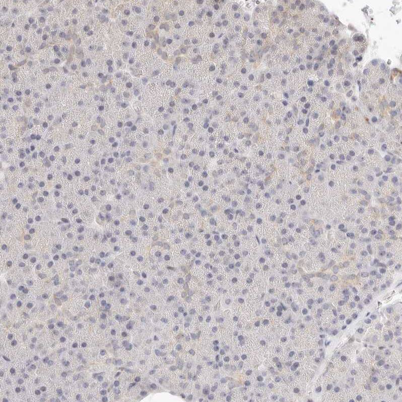 Immunohistochemistry-Paraffin ASCL3 Antibody - BSA Free