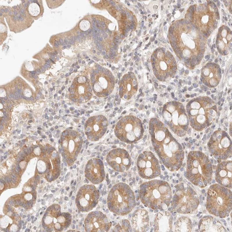 Staining of human duodenum shows moderate cytoplasmic positivity in glandular cells.