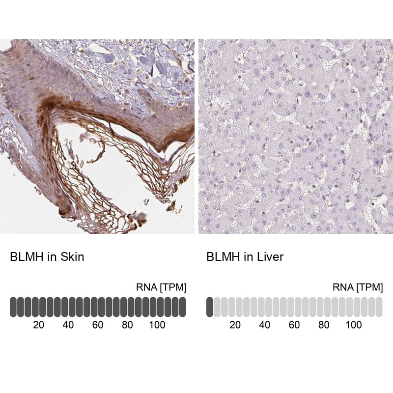 Immunohistochemistry-Paraffin BLMH/Bleomycin Hydrolase Antibody - BSA Free