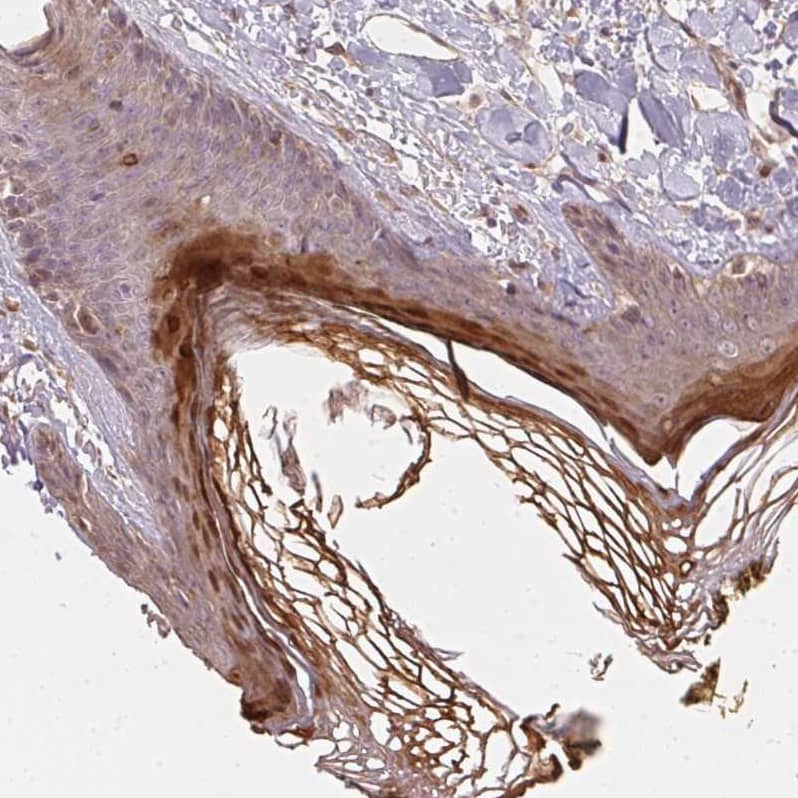 Staining of human skin shows strong cytoplasmic positivity in epidermal cells in corneal layer.