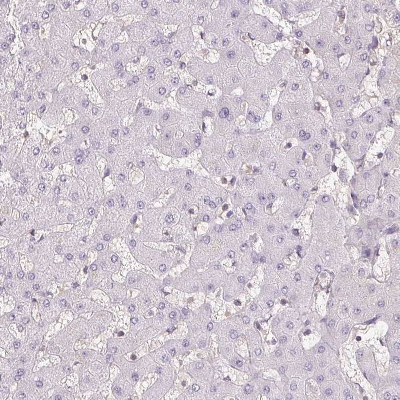 Staining of human liver shows no cytoplasmic positivity in hepatocytes.