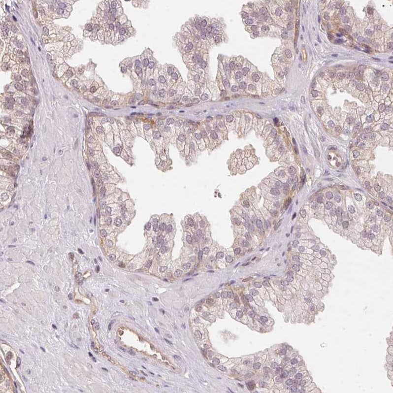 Staining of human prostate shows no cytoplasmic positivity in glandular cells as expected.