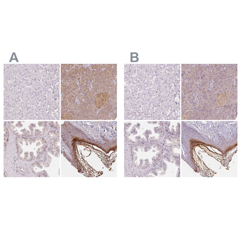 Staining of human liver, pancreas, prostate and skin HPA039548 (A) shows similar protein distribution across tissues to independent antibody HPA064307 (B).