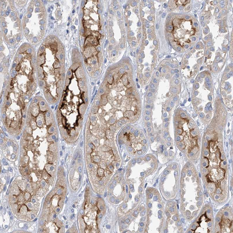Staining of human kidney shows strong membranous cytoplasmic positivity in cells in tubules.