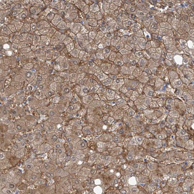 Staining of human liver shows strong membranous-cytoplasmic positivity in hepatocytes.