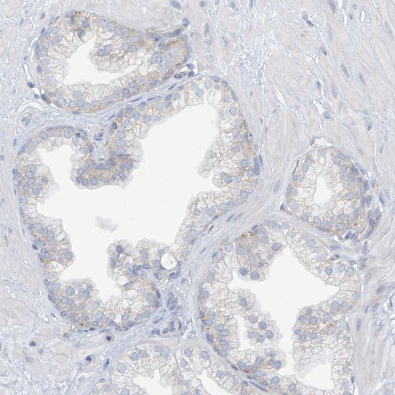 Staining of human prostate shows no positivity in glandular cells as expected.