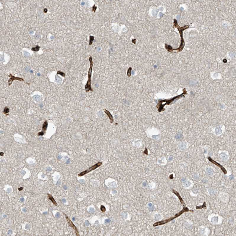 Staining of human cerebral cortex shows strong membranous cytoplasmic positivity in endothelial cells.