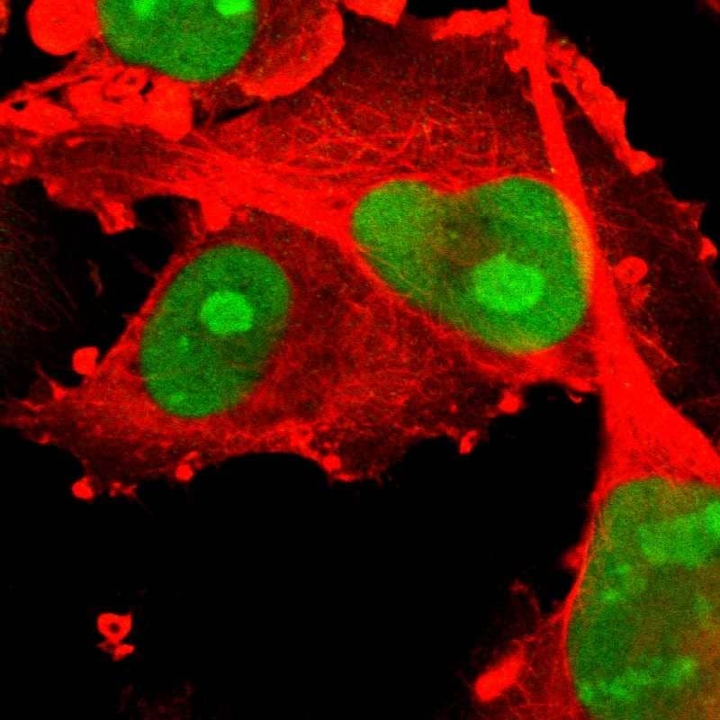 Immunocytochemistry/ Immunofluorescence PHF6 Antibody - BSA Free