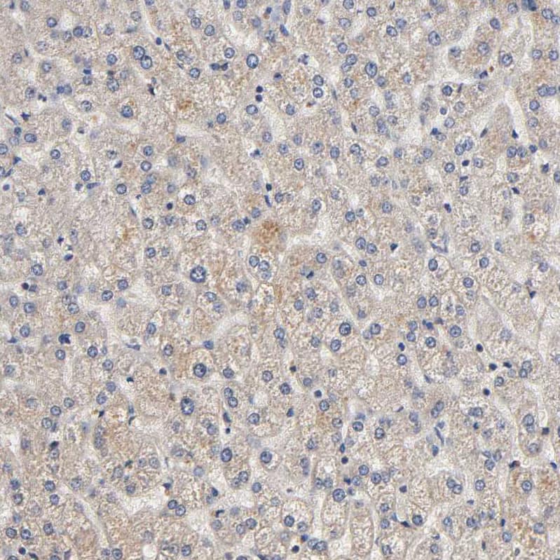 Immunohistochemistry-Paraffin ARHGEF7 Antibody - BSA Free