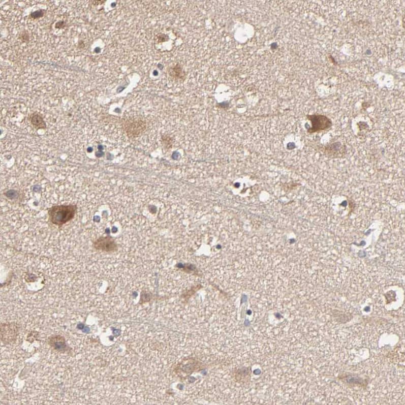 Staining of human cerebral cortex shows weak to moderate cytoplasmic positivity in neurons.