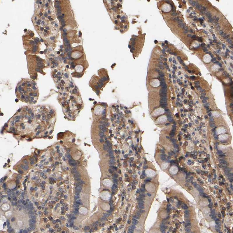 Staining of human duodenum shows moderate cytoplasmic positivity in glandular cells.