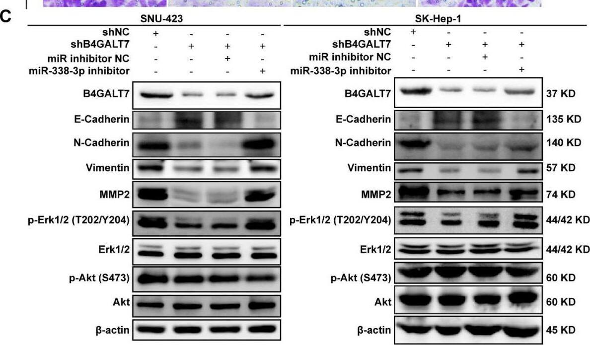 The effects of B4GALT7 and miR-338-3p on HCC cell invasion and migration.(A–B) Wound healing assay, matrigel-free and matrigel-based transwell assays were performed in SNU-423 and SK-Hep-1 cells transfected with shNC, shB4GALT7, and co-transfected with sh-B4GALT7 and the miR-338-3p inhibitor. Migration of the cells to the wound was photographed at 0 h and 48 h. Scale bar: 100 um. (C) Western blotting assay revealed the expression levels of EMT marker proteins and the phosphorylation status of signaling proteins can be rescued when co-transfected with sh-B4GALT7 and the miR-338-3p inhibitor. *, P < 0.05; **, P < 0.01. Image collected and cropped by CiteAb from the following open publication (//pubmed.ncbi.nlm.nih.gov/38025683), licensed under a CC-BY license. Not internally tested by Novus Biologicals.