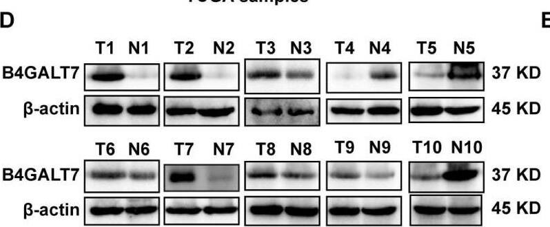 B4GALT7 is highly expressed in HCC tissues.(A) B4GALT7 expression levels in three GEO datasets, GSE14520, GSE25097 and GSE84402. (B) B4GALT7 levels in the TCGA database. (C) Survival probability of HCC patients with different expression of B4GALT7. The expression of B4GALT7 was analyzed by (D) western blotting and (E) real-time PCR in 10 pairs HCC samples and para-tumor specimens. (F) Representative immunohistochemical staining results of B4GALT7 based on the HPA database. (G) The expression landscape of B4GALT7 in the TIMER2.0 database. Image collected and cropped by CiteAb from the following open publication (//pubmed.ncbi.nlm.nih.gov/38025683), licensed under a CC-BY license. Not internally tested by Novus Biologicals.