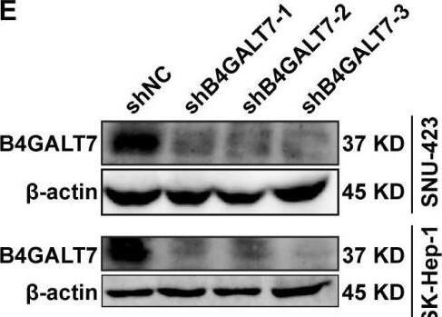 Down-regulation of B4GALT7 inhibits HCC cell proliferative abilities in vitro.(A) qPCR and (B) Western blotting analysis of the expression of B4GALT7 in HCC cells (SNU-423, SMMC-7721, SK-Hep-1, HepG2, Huh-7) and normal liver cell HL-7702. (C) Representative pictures of the green fluorescence intensity of HCC cells after transfected with shRNA vectors to mediate B4GALT7 inhibition. (D) qPCR and (E) Western blotting analysis of B4GALT7 expression in HCC cells after transfected as in C. Down-regulation of B4GALT7 inhibits the proliferative abilities of HCC cells (SNU-423, SK-Hep-1) determined by (F) MTT assay and (G) Colony formation assay. (H) Representative pictures of flow cytometry analysis of apoptosis stained with Annexin V-APC and 7-AAD in HCC cells transfected as in C. Scale bar: 100 um. Mean +/- SD for three independent experiments are demonstrated. *, P < 0.05; **, P < 0.01. Image collected and cropped by CiteAb from the following open publication (//pubmed.ncbi.nlm.nih.gov/38025683), licensed under a CC-BY license. Not internally tested by Novus Biologicals.