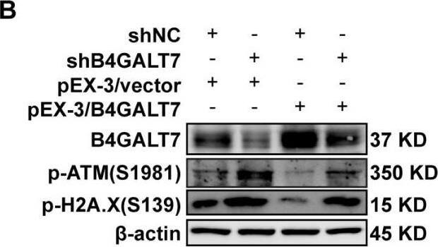 Down-regulation of B4GALT7 results in DNA damage and arrests the cell cycle at the G2/M phase.(A–B) p-ATM and p-H2A. X protein levels in SNU-423 and SK-Hep-1 cells transfected with shB4GALT7 or shNC, and further transfected with pEX-3/B4GALT7 or pEX-3/vector. (C) Cell cycle analysis in SNU-423 and SK-Hep-1 cells after shRNA mediated B4GALT7 inhibition. Mean +/- SD for three independent experiments are demonstrated. (D–E) p-Chk2, p-Wee1, p-cdc2 and cyclin B1 protein levels in B4GALT7-downregulation SNU-423 and SK-Hep-1 cells, and further transfected with pEX-3/B4GALT7 or pEX-3/vector. *, P < 0.05; **, P < 0.01. Image collected and cropped by CiteAb from the following open publication (//pubmed.ncbi.nlm.nih.gov/38025683), licensed under a CC-BY license. Not internally tested by Novus Biologicals.