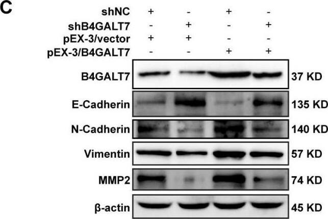 The effects of B4GALT7 and miR-338-3p on HCC cell invasion.(A) Matrigel-based transwell assay was conducted in HCC cells transfected with pEX-3/vector, pEX-3/B4GALT7, and co-transfected with pEX-3/B4GALT7 and miR-338-3p mimics. (B) Western blotting assay revealed the expression levels of EMT marker proteins can be reversed when co-transfected with pEX-3/B4GALT7 and miR-338-3p mimics. (C) Representative western blots of EMT marker protein levels in SNU-423 cells transfected with shB4GALT7 or shNC, and further transfected with pEX-3/B4GALT7 or pEX-3/vector. *, P < 0.05; **, P < 0.01. Image collected and cropped by CiteAb from the following open publication (//pubmed.ncbi.nlm.nih.gov/38025683), licensed under a CC-BY license. Not internally tested by Novus Biologicals.