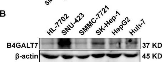 Down-regulation of B4GALT7 inhibits HCC cell proliferative abilities in vitro.(A) qPCR and (B) Western blotting analysis of the expression of B4GALT7 in HCC cells (SNU-423, SMMC-7721, SK-Hep-1, HepG2, Huh-7) and normal liver cell HL-7702. (C) Representative pictures of the green fluorescence intensity of HCC cells after transfected with shRNA vectors to mediate B4GALT7 inhibition. (D) qPCR and (E) Western blotting analysis of B4GALT7 expression in HCC cells after transfected as in C. Down-regulation of B4GALT7 inhibits the proliferative abilities of HCC cells (SNU-423, SK-Hep-1) determined by (F) MTT assay and (G) Colony formation assay. (H) Representative pictures of flow cytometry analysis of apoptosis stained with Annexin V-APC and 7-AAD in HCC cells transfected as in C. Scale bar: 100 um. Mean +/- SD for three independent experiments are demonstrated. *, P < 0.05; **, P < 0.01. Image collected and cropped by CiteAb from the following open publication (//pubmed.ncbi.nlm.nih.gov/38025683), licensed under a CC-BY license. Not internally tested by Novus Biologicals.