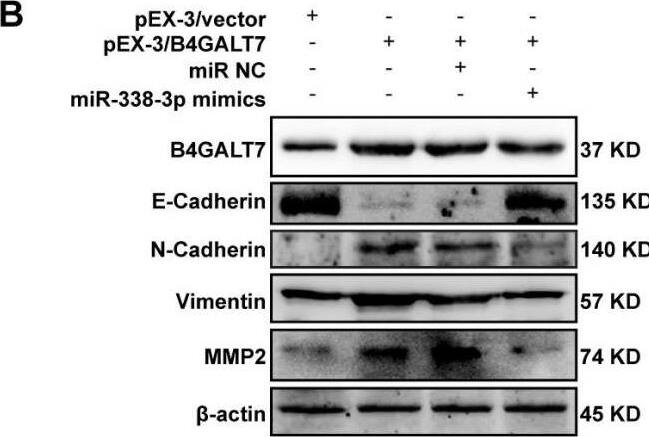 The effects of B4GALT7 and miR-338-3p on HCC cell invasion.(A) Matrigel-based transwell assay was conducted in HCC cells transfected with pEX-3/vector, pEX-3/B4GALT7, and co-transfected with pEX-3/B4GALT7 and miR-338-3p mimics. (B) Western blotting assay revealed the expression levels of EMT marker proteins can be reversed when co-transfected with pEX-3/B4GALT7 and miR-338-3p mimics. (C) Representative western blots of EMT marker protein levels in SNU-423 cells transfected with shB4GALT7 or shNC, and further transfected with pEX-3/B4GALT7 or pEX-3/vector. *, P < 0.05; **, P < 0.01. Image collected and cropped by CiteAb from the following open publication (//pubmed.ncbi.nlm.nih.gov/38025683), licensed under a CC-BY license. Not internally tested by Novus Biologicals.