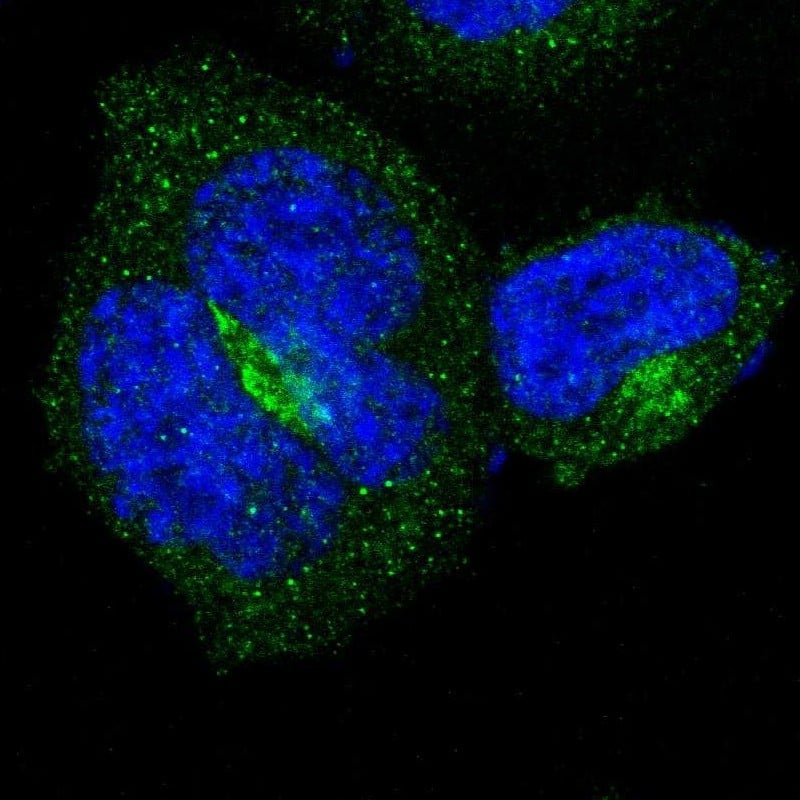 Staining of human cell line A-431 shows localization to cytosol & the Golgi apparatus.
