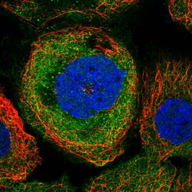 Staining of human cell line A-431 shows localization to cytosol.