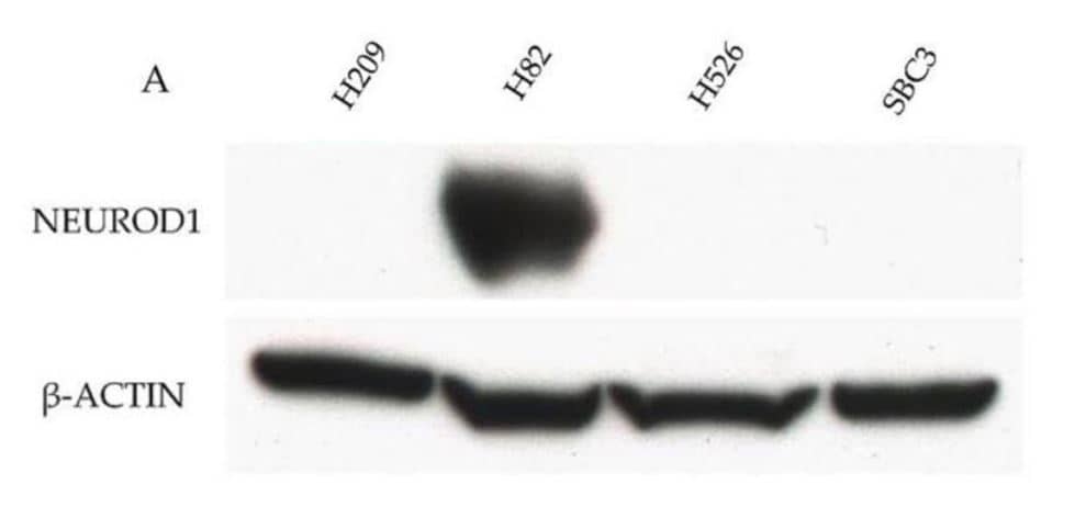 Western Blot: NeuroD1 Antibody [NBP1-88661] - Example of the positive control of the four key molecules by WB in SCLC cell lines. NeuroD1 was strongly expressed in H82 cells. Beta-actin served as an internal control. Image collected and cropped by CiteAb from the following publication (//pubmed.ncbi.nlm.nih.gov/33202998/) licensed under a CC-BY license.