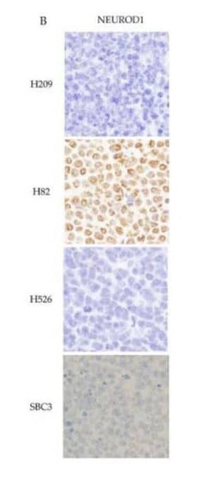 Immunohistochemistry: NeuroD1 Antibody [NBP1-88661] - Example of the positive control of the four key molecules in xenotransplanted tumor tissues from the four cell lines in mice by IHC. NeuroD1 staining was found in the tumor cell nuclei of H82 cells. Image collected and cropped by CiteAb from the following publication (//pubmed.ncbi.nlm.nih.gov/33202998/) licensed under a CC-BY license.