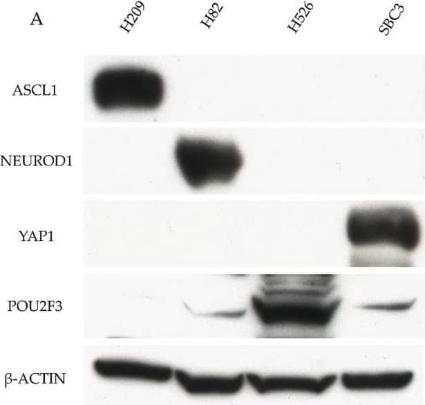 Western Blot: NeuroD1 Antibody [NBP1-88661] - Example of the positive control of four key molecules by WB & IHC in SCLC samples. (A) Example of the positive control of the four key molecules by WB in SCLC cell lines. ASCL1 was strongly expressed in H209 cells. NeuroD1 was strongly expressed in H82 cells. Pou2F3 was strongly expressed in H526 cells & weakly expressed in H82 & SBC3 cells. YAP1 was strongly expressed in SBC3 cells.  beta -actin served as an internal control. (B) Example of the positive control of the four key molecules in xenotransplanted tumor tissues from the four cell lines in mice by IHC. ASCL1 staining was found in tumor cell nuclei of H209 cells. NeuroD1 staining was found in the tumor cell nuclei of H82 cells. Pou2F3 staining with a diffuse cytoplasmic pattern was found in H82, H526, & SBC3 cells. The Pou2F3 staining intensity was weak in H82 & SBC3 cells & strong in H526 cells. YAP1 was stained with a membranous pattern in SBC3 cells. Scale bar = 50 μm. Image collected & cropped by CiteAb from the following publication (//pubmed.ncbi.nlm.nih.gov/33202998), licensed under a CC-BY license. Not internally tested by Novus Biologicals.