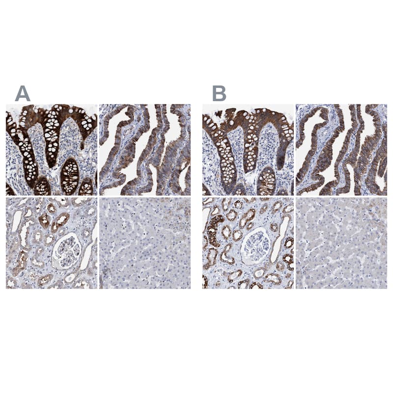Immunohistochemistry-Paraffin MKS1 Antibody - BSA Free