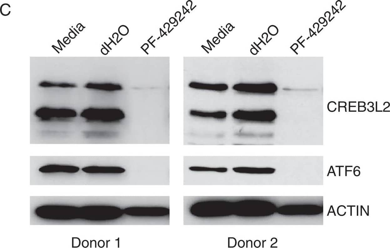 Western Blot: CREB3L2 Antibody [NBP1-88697] - S1P inhibition induces autophagy & affects multiple UPR-related TFs. (A) In vitro day 3 B-cells were treated with 10 μM PF-429242 or vehicle control (dH2O) for 72 h & were assessed for cell number using CountBright beads. Shown are the average cell numbers from 7 donors ± standard deviations. Protein lysates generated from day 3 cells treated for 72 h with 10 μM PF-429242 were evaluated for (B) autophagy markers or (C) CREB3L2 & ATF6 by Western blotting. Shown are representative results from 2 donors, a total of 7 donors were evaluated. Image collected & cropped by CiteAb from the following publication (//pubmed.ncbi.nlm.nih.gov/30254311), licensed under a CC-BY license. Not internally tested by Novus Biologicals.