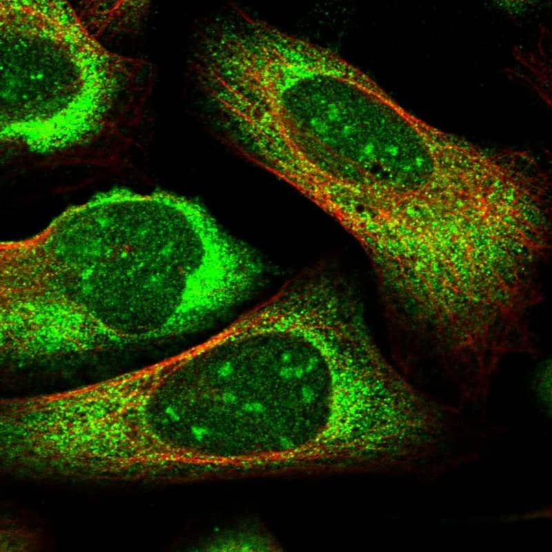 Staining of human cell line U-2 OS shows localization to nucleoli & cytosol.