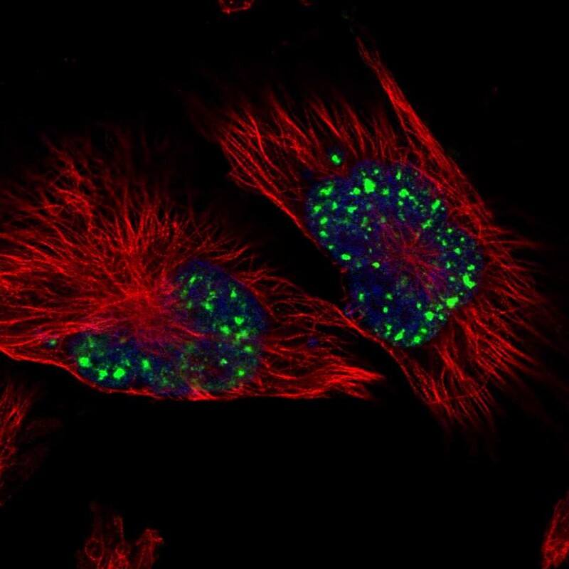 Staining of human cell line U-251 MG shows localization to nuclear speckles.