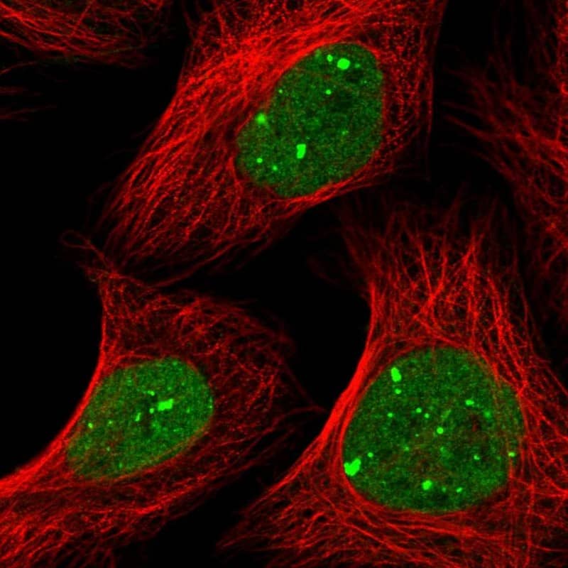 Staining of human cell line U-2 OS shows localization to nuclear bodies.