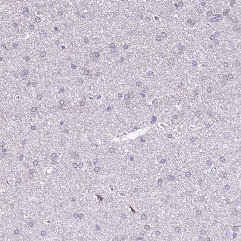Immunohistochemistry-Paraffin BANK1 Antibody - BSA Free