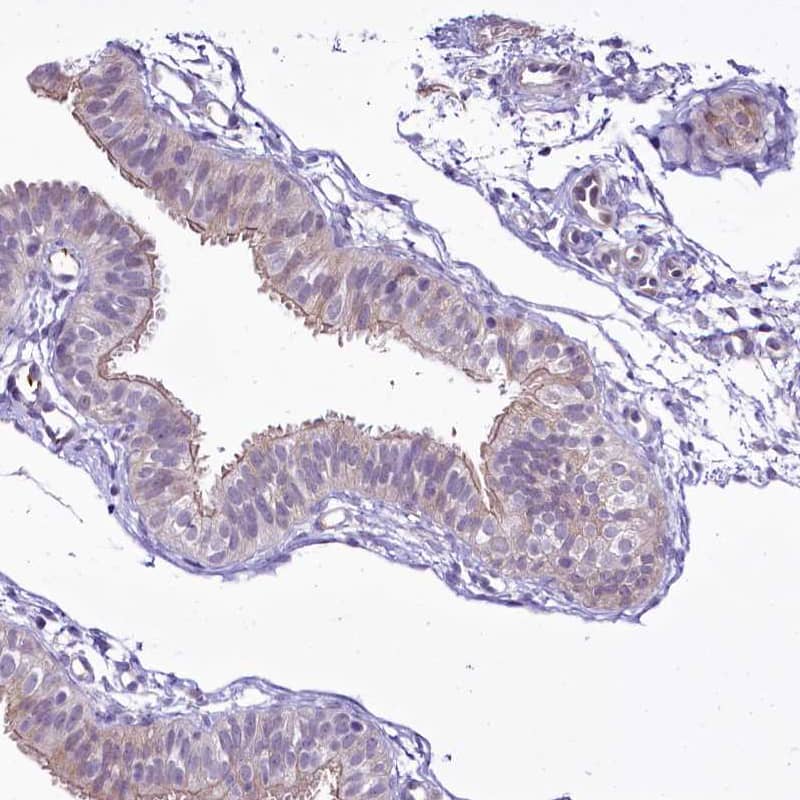 Immunohistochemistry-Paraffin BANK1 Antibody - BSA Free