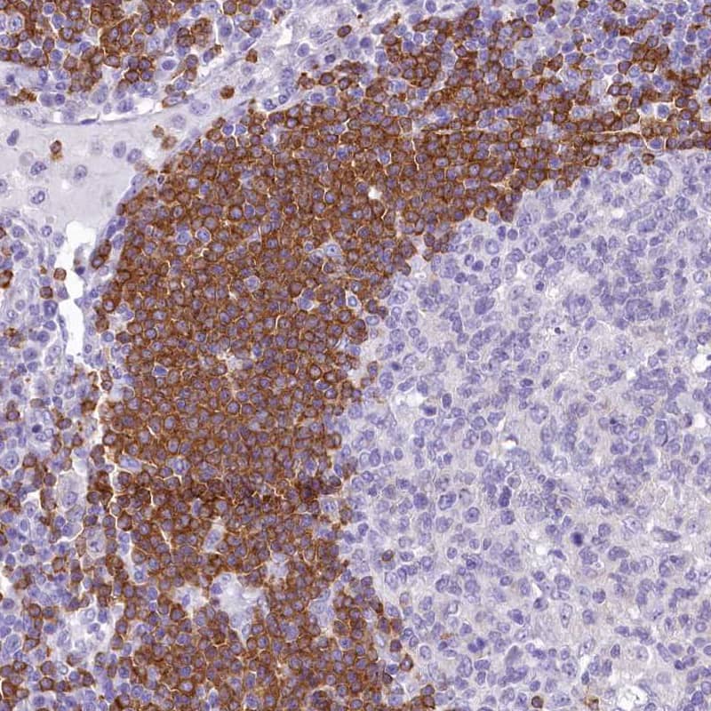 Immunohistochemistry-Paraffin BANK1 Antibody - BSA Free