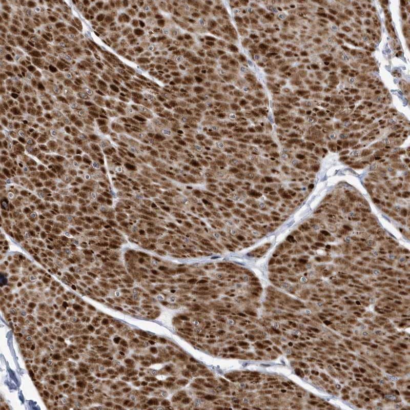 Staining of human smooth muscle shows strong cytoplasmic positivity in smooth muscle cells.