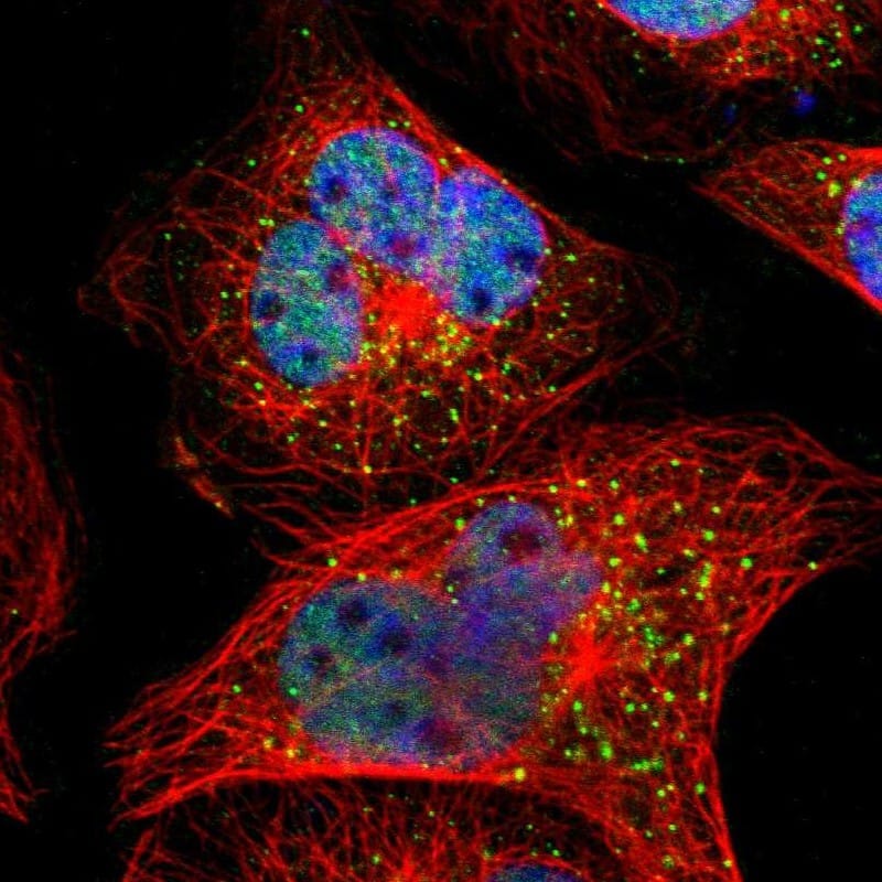 Staining of human cell line A-431 shows localization to nucleoplasm & vesicles.