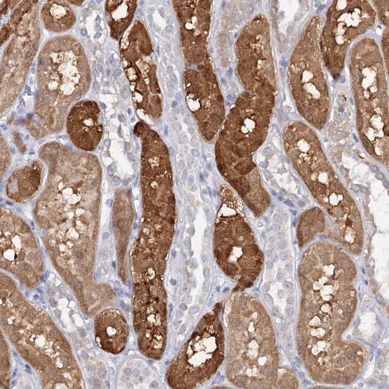 Immunohistochemistry-Paraffin SFRS18 Antibody - BSA Free