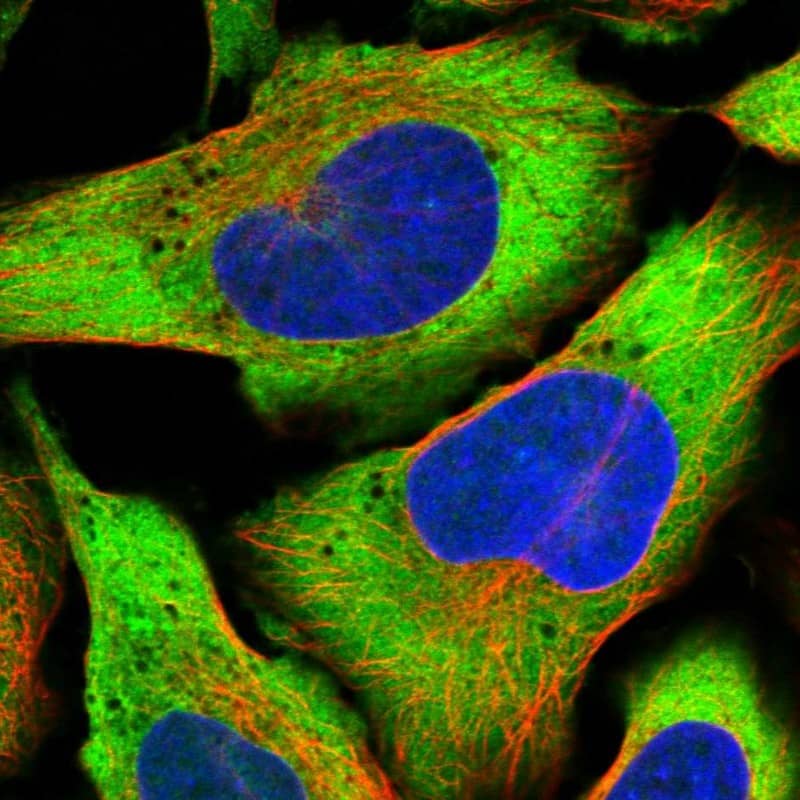 Staining of human cell line U-2 OS shows localization to cytosol.