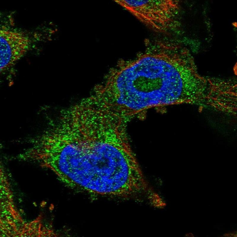 Staining of human cell line U-251 MG shows localization to cytosol.