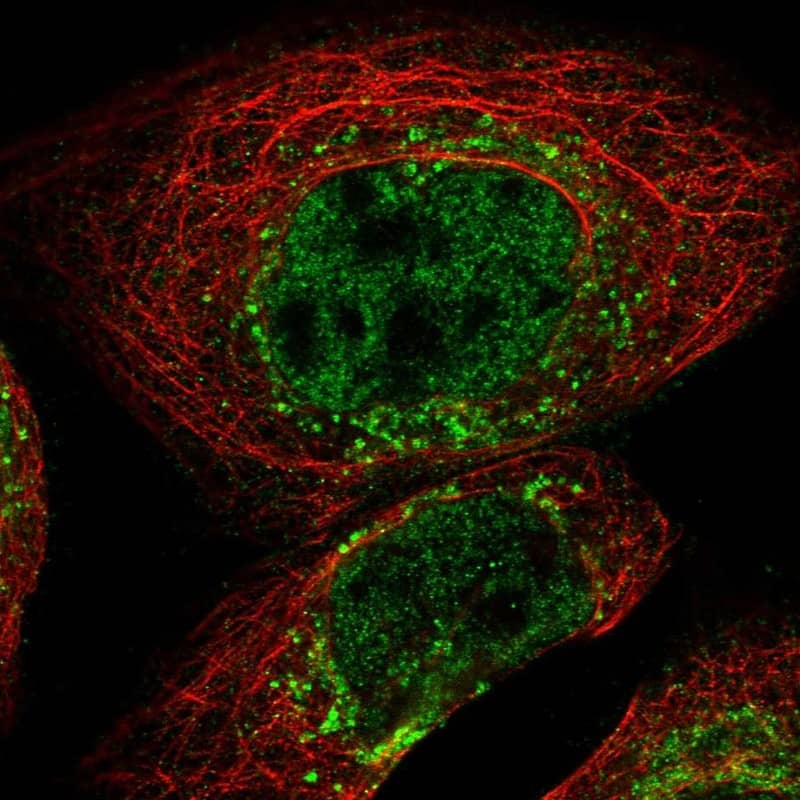 Staining of human cell line A-431 shows localization to nucleoplasm, the Golgi apparatus & vesicles.