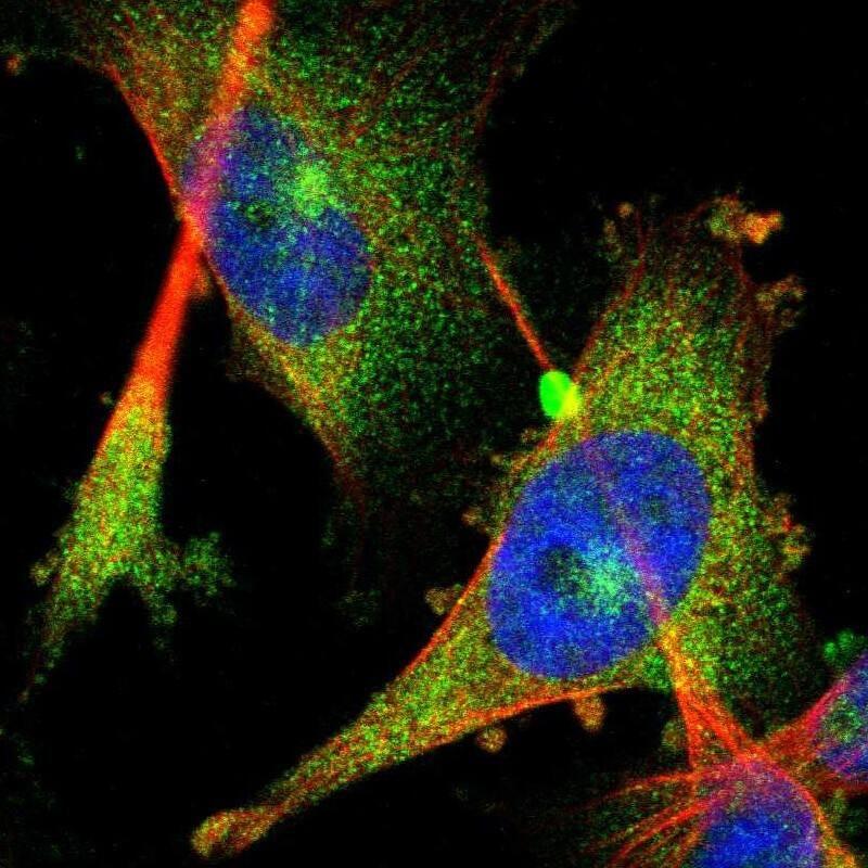 Staining of human cell line U-251 MG shows localization to cytosol.
