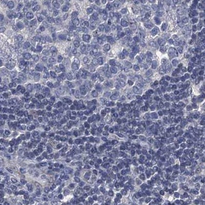 <b>Independent Antibodies Validation. </b>Staining of human lymph node 