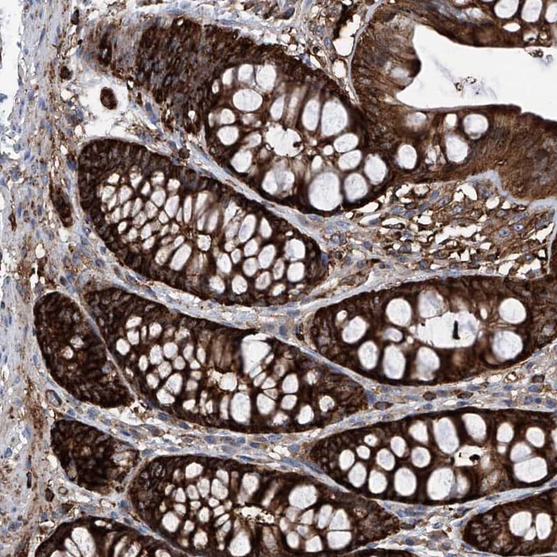 Staining of human colon shows strong cytoplasmic positivity in glandular cells.