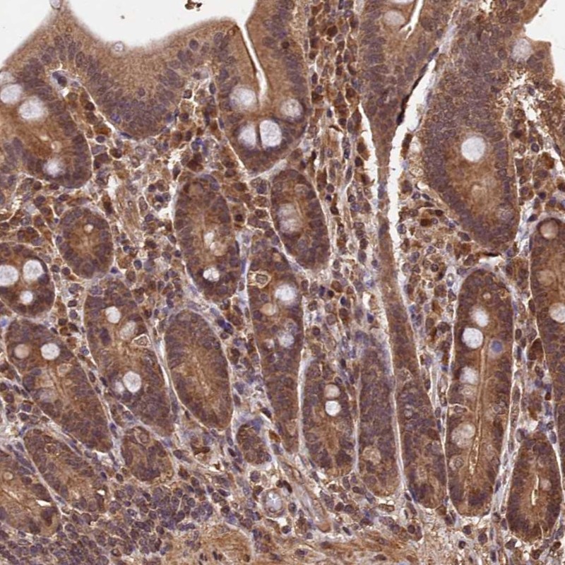 Staining of human duodenum shows moderate cytoplasmic and nuclear positivity in glandular cells.